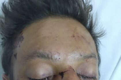 SES-AM pede ajuda para encontrar familiares de paciente internado no HPS João Lúcio