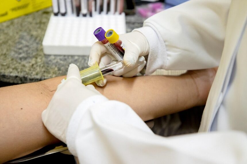 Prefeitura de Manaus apresenta avanços no acompanhamento da Tuberculose