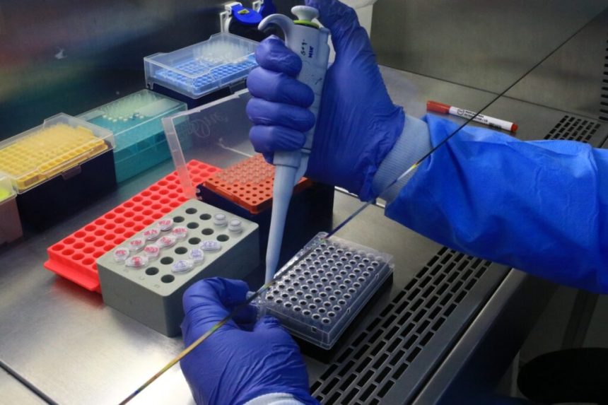 Informe Epidemiológico de Mpox atualiza situação da doença no Amazonas, nesta quarta-feira