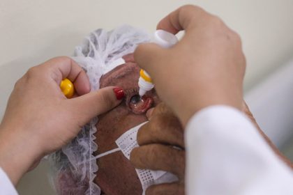 Governo do Amazonas aumenta a oferta de cirurgias de catarata com programação intensificada até fevereiro de 2025