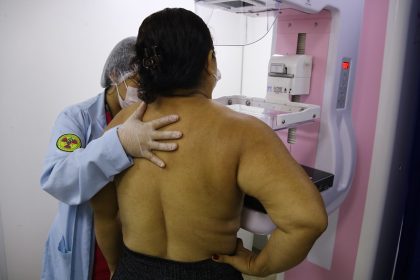 Interior: Carreta da Saúde do Governo do Amazonas começa o ano com a oferta de mais de 2,4 mil exames em Iranduba