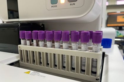 Fundação Adriano Jorge realizou mais de 281 mil exames de imagem e laboratoriais em 2024