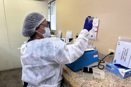 Vigilância em Saúde: Lacen-AM e Lafron realizaram 494 mil processos laboratoriais em 2024