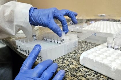 FVS-RCP divulga informe epidemiológico de Vírus Respiratórios no Amazonas