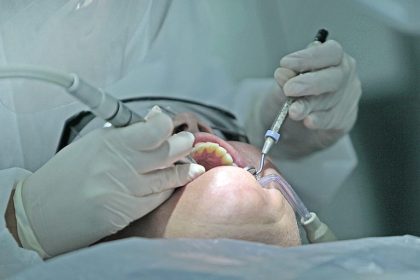 Comissão debate riscos do mercúrio na odontologia