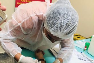 Amazonas é destaque nacional em experiências exitosas de enfrentamento à tuberculose