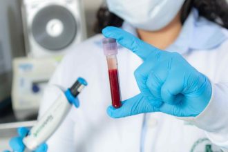 Hemoam mantém certificação ISO 9001 e reforça excelência nos serviços à população