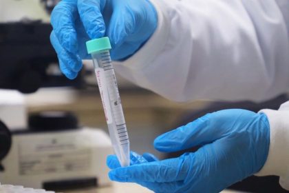 FVS-RCP atualiza informe sobre vírus respiratórios no Amazonas e registra 5.000 casos notificados até 22 de novembro de 2025