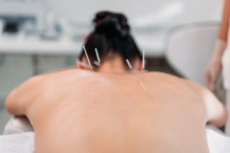 Lei regulamenta exercício profissional da acupuntura