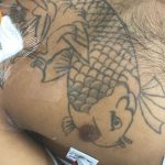 Hospital João Lúcio pede ajuda da população para identificar paciente internado em estado gravíssimo