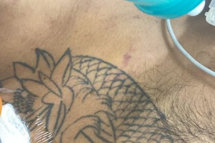 Hospital João Lúcio pede ajuda da população para identificar paciente internado em estado gravíssimo