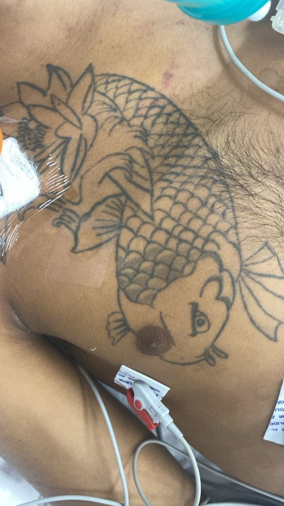 Hospital João Lúcio pede ajuda da população para identificar paciente internado em estado gravíssimo