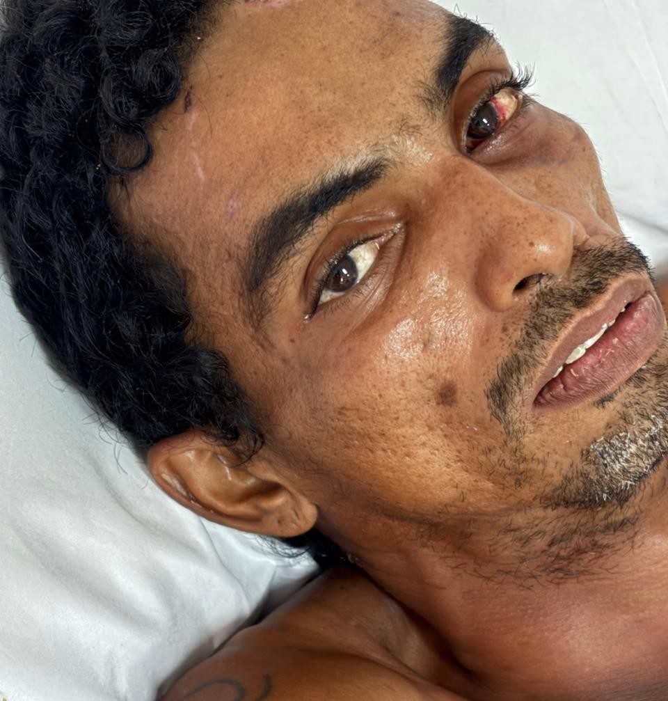 Homem deu entrada na unidade pelo SAMU, após sofrer choque elétrico