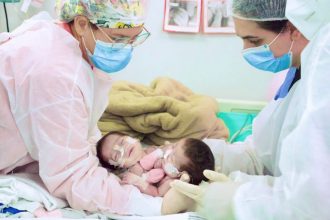 Siamesas que nasceram na maternidade Ana Braga completam um ano e atestam avanço da saúde no Amazonas